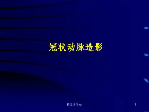 《冠脉造影》PPT课件