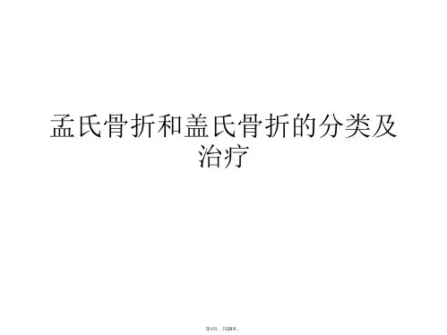 孟氏骨折和盖氏骨折的分类及治疗