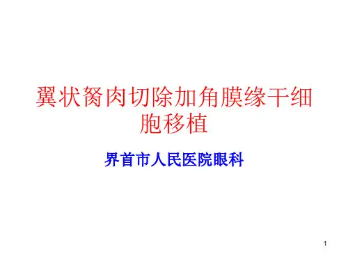 翼状胬肉切除加角膜缘干细胞移植PPT课件