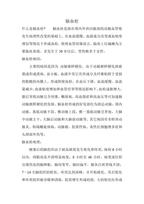 脑血栓病因与诊断