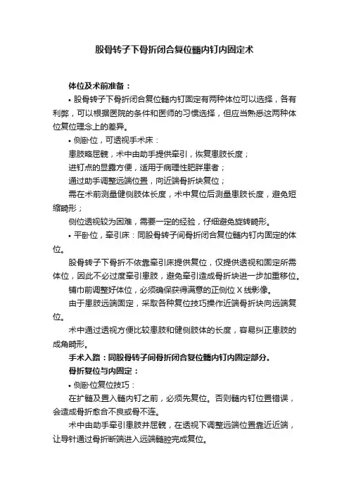 股骨转子下骨折闭合复位髓内钉内固定术