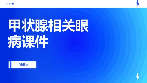 甲状腺相关眼病课件
