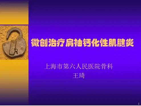 微创治疗肩袖钙化性肌腱参考幻灯片