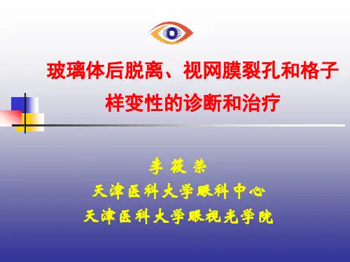 玻璃体后脱离、视网膜裂孔和格子样变性的诊断和治疗