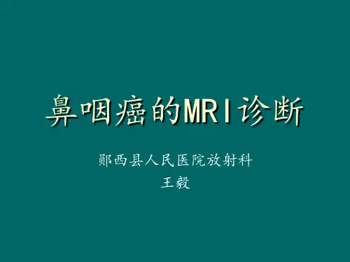 鼻咽癌的MRI诊断