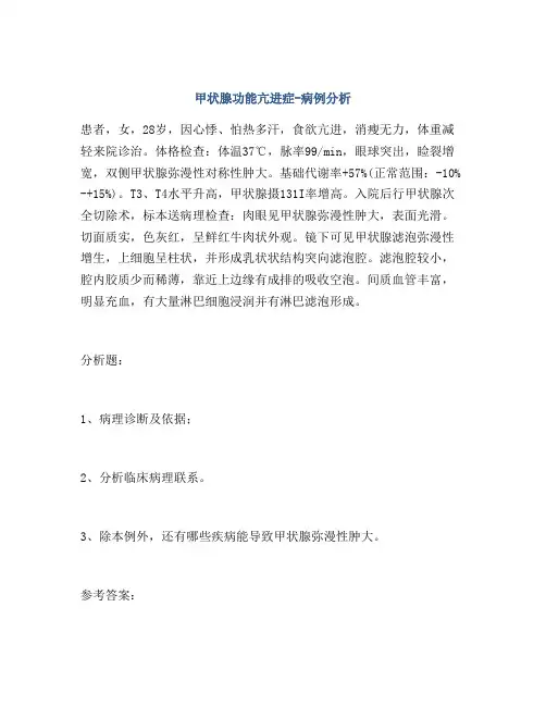 甲状腺功能亢进症-病例分析
