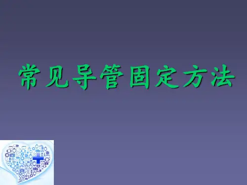 常见导管固定方法ppt课件