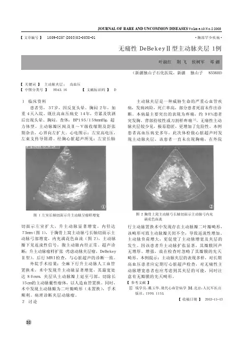 无痛性DeBekey型主动脉夹层1例