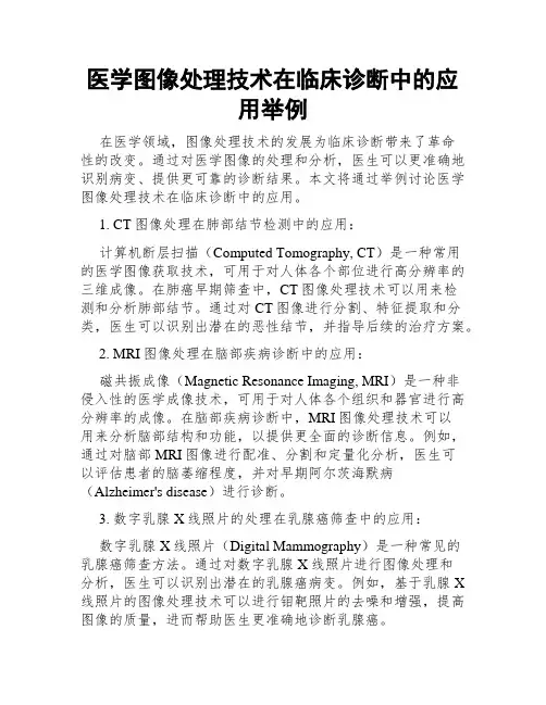 医学图像处理技术在临床诊断中的应用举例