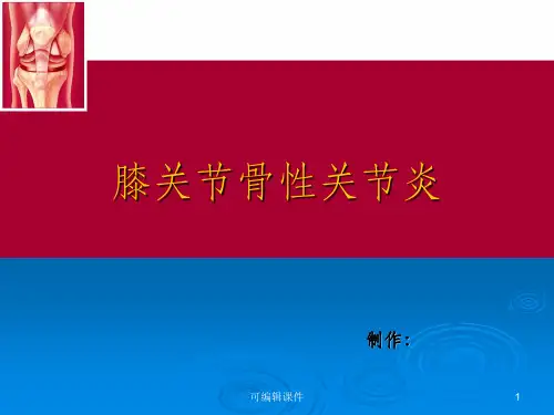 膝关节骨性关节炎10414ppt课件