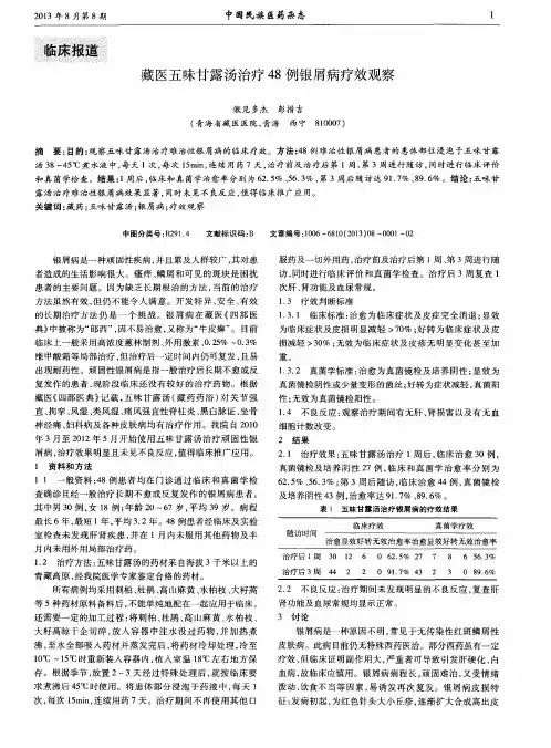 藏医五味甘露汤治疗48例银屑病疗效观察
