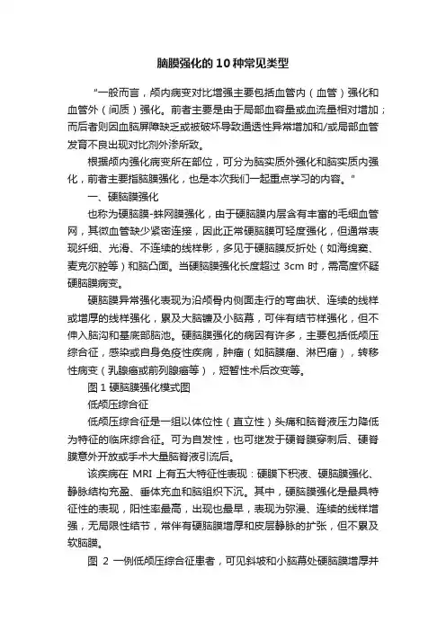 脑膜强化的10种常见类型