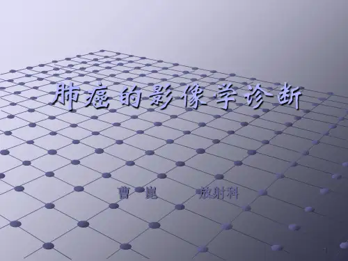 新编文档肺癌影像诊断讲课精品文档PPT课件