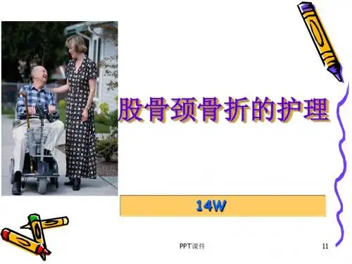 股骨颈骨折的护理 ppt课件
