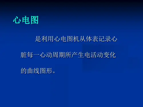 心电图岗前培训课件