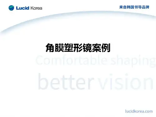 角膜塑形镜案例ppt课件