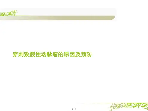 穿刺致假性动脉瘤的原因及预防
