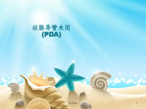 动脉导管未闭