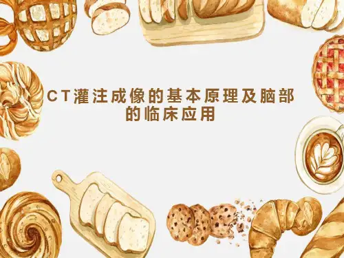 CT灌注成像的基本原理及脑部的临床应用