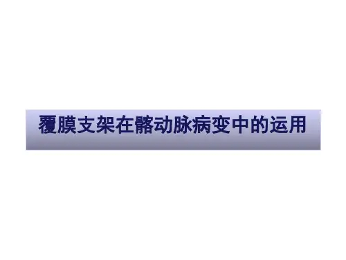 覆膜支架在髂动脉疾病中的运用学习课件