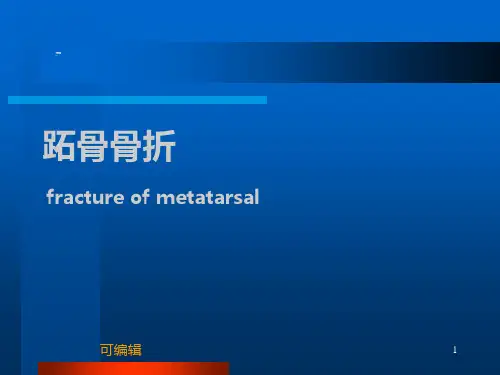 跖骨骨折-PPT课件