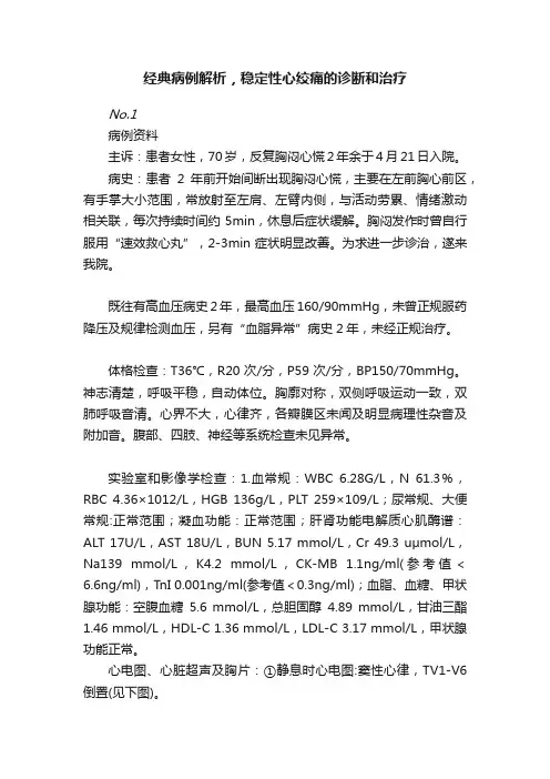 经典病例解析，稳定性心绞痛的诊断和治疗