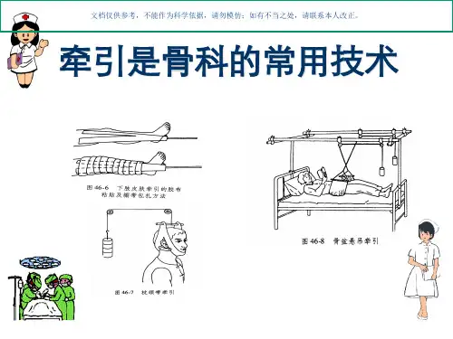 骨科常见牵引的种类和方法课件