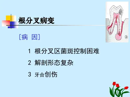 根分叉病变课件