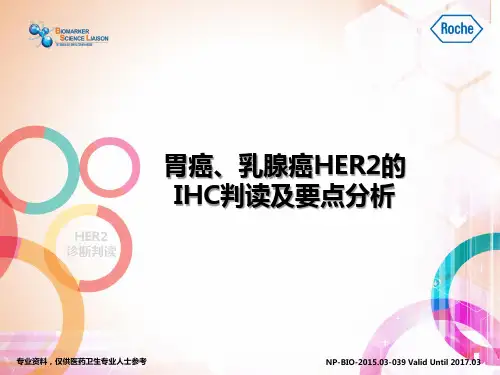HER 的IHC判读和要点分析