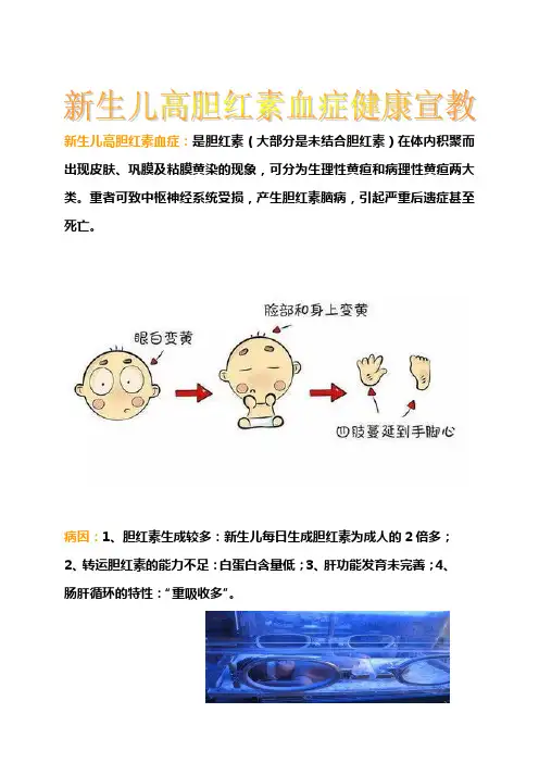 新生儿高胆红素血症健康宣教材料