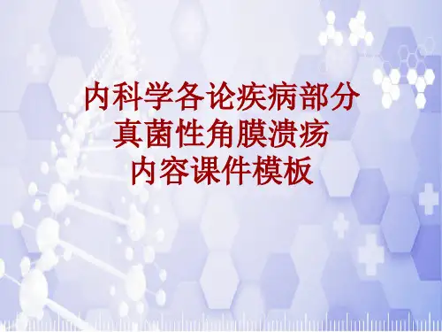 内科学_各论_疾病：真菌性角膜溃疡_课件模板