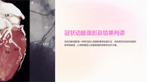 冠状动脉造影及结果判读