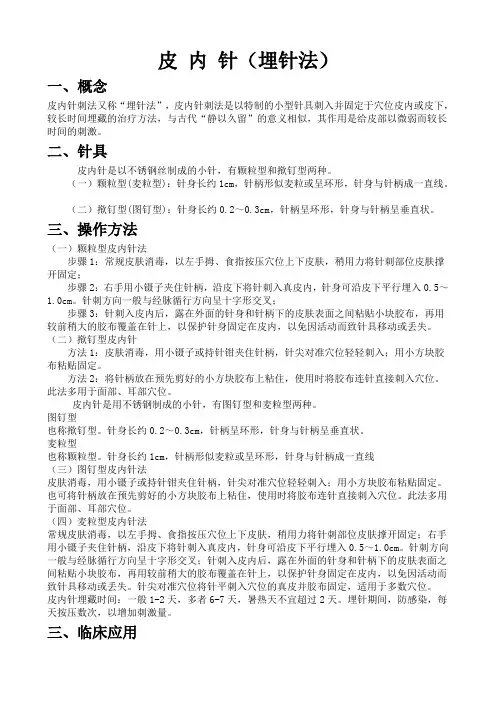 皮内针(操作规范)