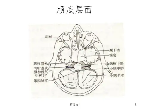 《头颅CT示意图》PPT课件