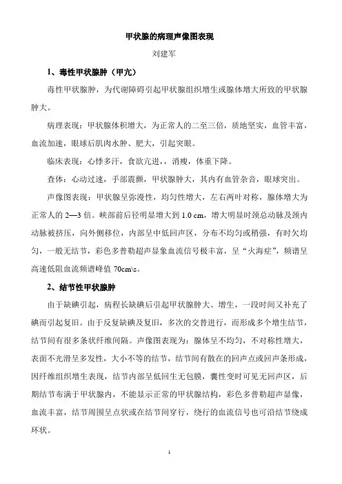 甲状腺的病理声像图表现