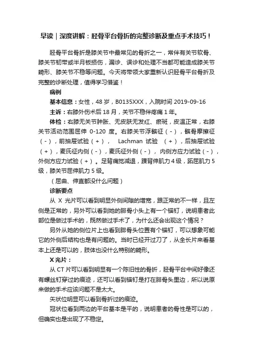 早读｜深度讲解：胫骨平台骨折的完整诊断及重点手术技巧！