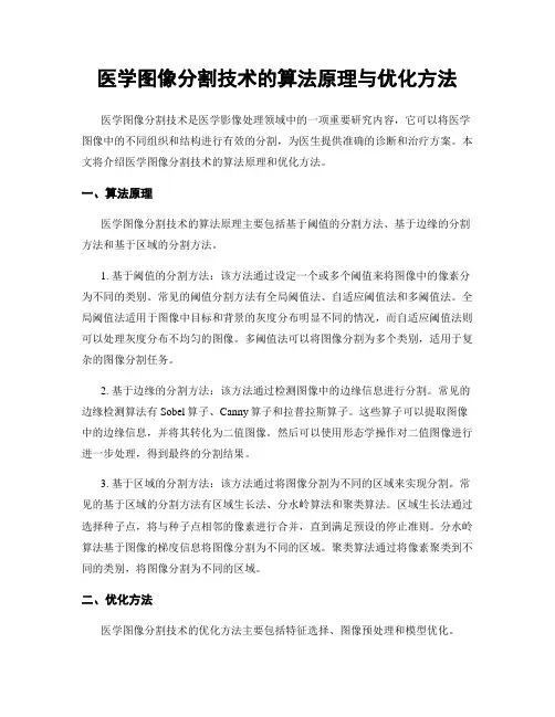 医学图像分割技术的算法原理与优化方法