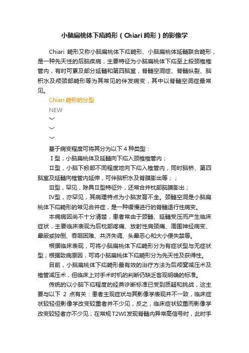 小脑扁桃体下疝畸形（Chiari畸形）的影像学