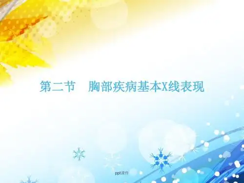 胸部疾病基本X线表现  ppt课件
