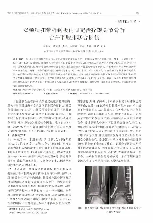 双锁纽扣带袢钢板内固定治疗踝关节骨折合并下胫腓联合损伤