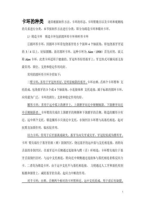 卡环的种类
