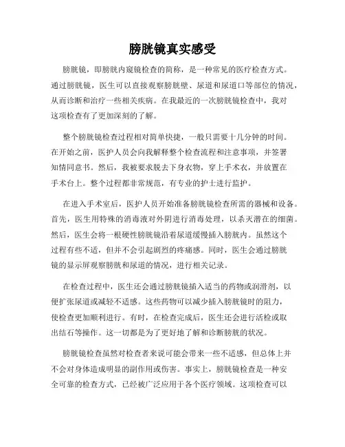 膀胱镜真实感受