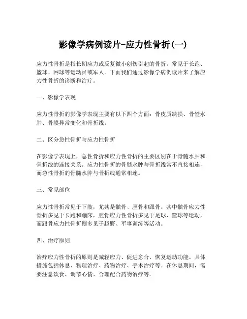 影像学病例读片-应力性骨折(一)