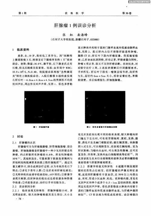 肝腺瘤1例误诊分析