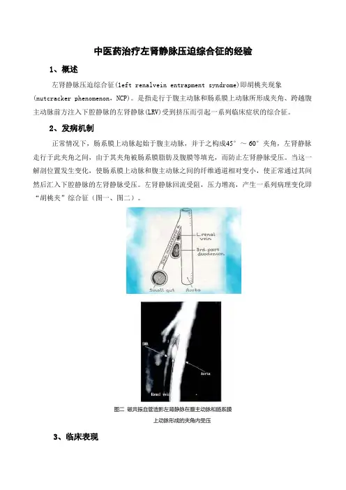 中医药治疗左肾静脉压迫综合征的经验