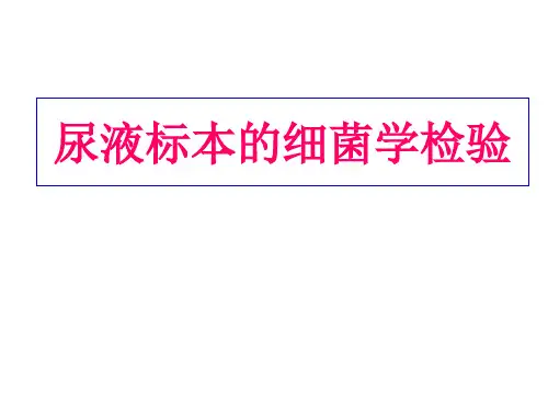 尿液标本细菌检验