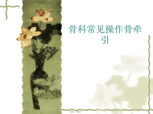 骨科常见操作骨牵引PPT