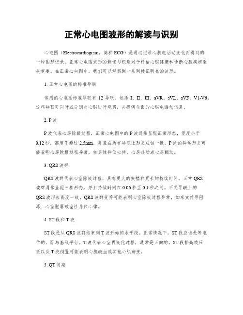 正常心电图波形的解读与识别