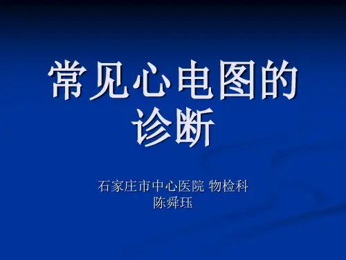 常见心电图的诊断