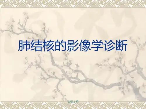 肺结核的影像学诊断